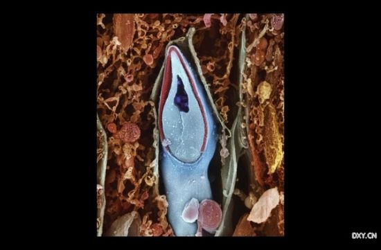 ���������棬�Ŵ����ʴ����ھ��ӵ�ͷ��