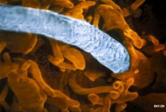 ����ͷ���Ѿ���ȫ�������ӣ�ֻ����β��