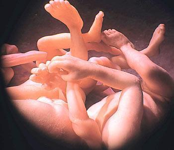 子宫中20-30周大的双胞胎胎儿