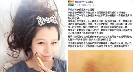 徐若瑄怀孕毅力惊人 徐若瑄怀孕毅力惊人