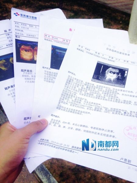 1月29日在人民医院做的B超单到2月1日才知道结果。南都记者 何永华 摄 1月29日在人民医院做的B超单到2月1日才知道结果。南都记者 何永华 摄