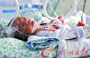 因为早产,婴儿仍需要接受治疗,现在胃部吸收还不太好。 因为早产,婴儿仍需要接受治疗,现在胃部吸收还不太好。