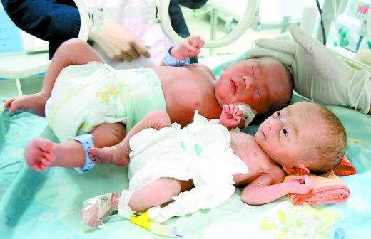 李女士在南川区人民医院妇儿分院进行剖宫产,顺利产下一对双胞胎,其中一名胎儿体重仅700g。 李女士在南川区人民医院妇儿分院进行剖宫产,顺利产下一对双胞胎,其中一名胎儿体重仅700g。