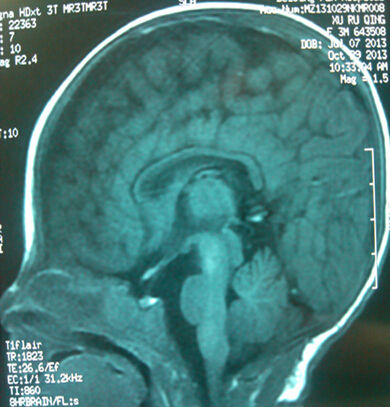  MRI,