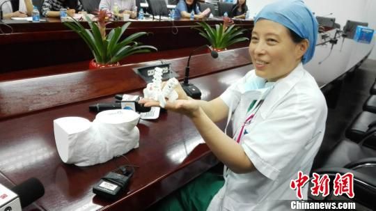 在本次江西联体女婴的病例中,该院首次使用3D打印技术,等比例地还原患儿臀部联体的脊柱、皮肤融合情况,直观展现患儿骨性连接和皮肤连接的部位和程度,实现虚拟术前切割、皮瓣翻转。郑珊向记者展示3D打印出的脊柱融 在本次江西联体女婴的病例中,该院首次使用3D打印技术,等比例地还原患儿臀部联体的脊柱、皮肤融合情况,直观展现患儿骨性连接和皮肤连接的部位和程度,实现虚拟术前切割、皮瓣翻转。郑珊向记者展示3D打印出的脊柱融