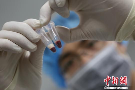 患儿的血液(左)呈乳白色 王希哲 摄 患儿的血液(左)呈乳白色 王希哲 摄