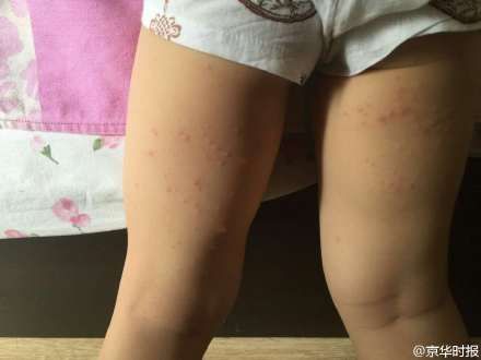 �׶�԰����������ڲ�